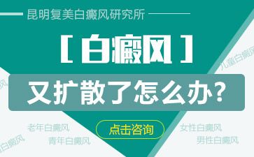 昆明白斑病哪里治疗比较好为什么女人更容易患发白癜风