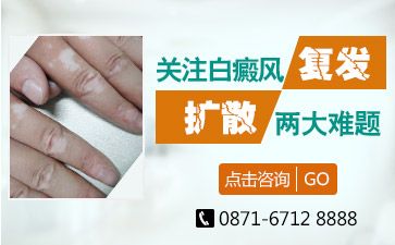 昆明专科白癜风医院那个比较好